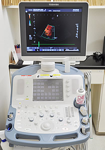 超音波診断装置